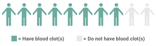 Image showing 8 out of 10 patients having a clot by age 50